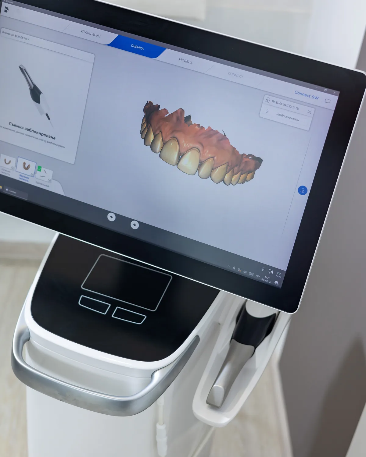 Cyfrowy skan uzębienia na monitorze w Bas Clinic we Wrocławiu