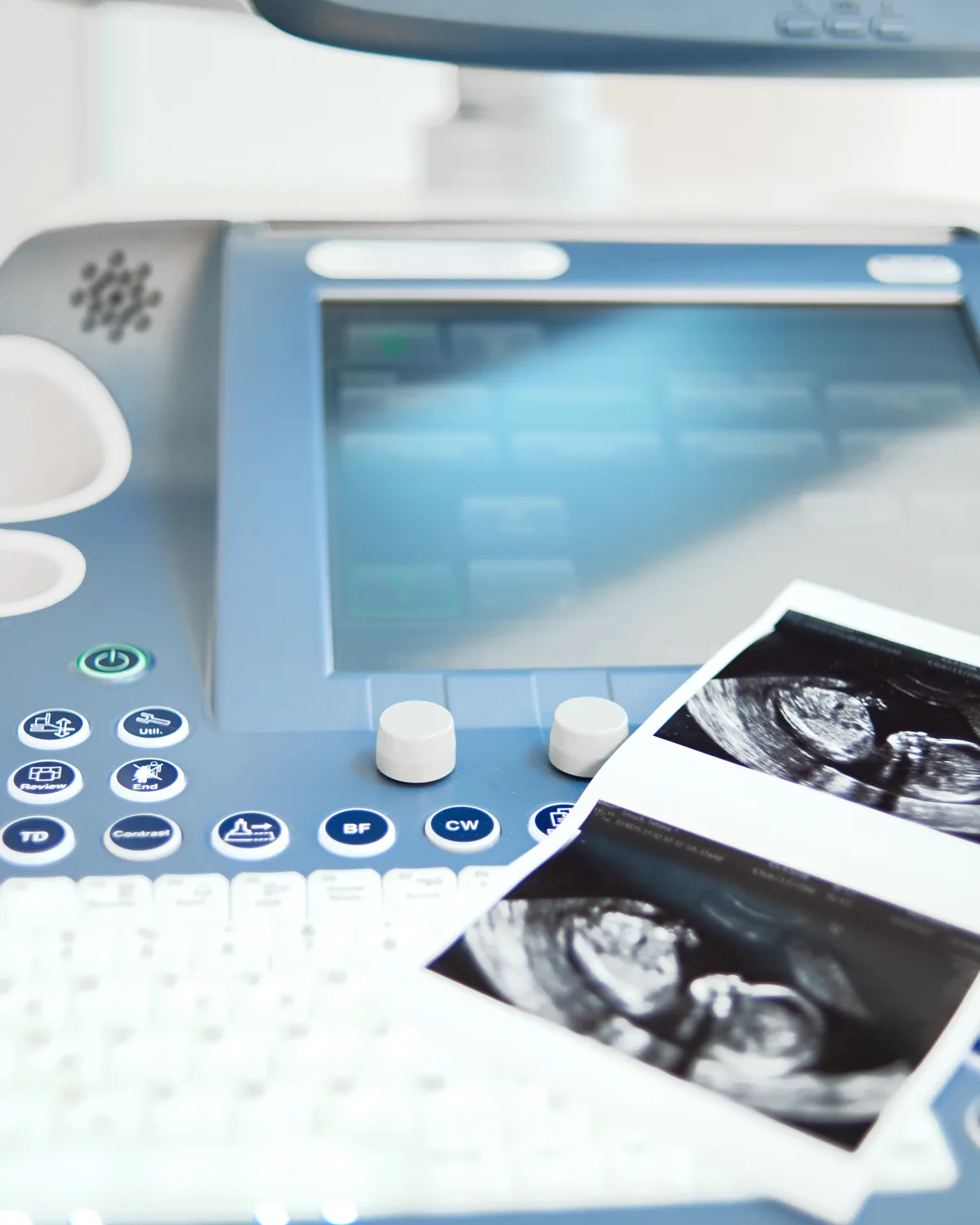 Konsola aparatu USG w Bas Clinic we Wrocławiu